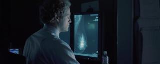 Photo of doctor looking at breast imaging scans