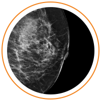 Image of a breast scan