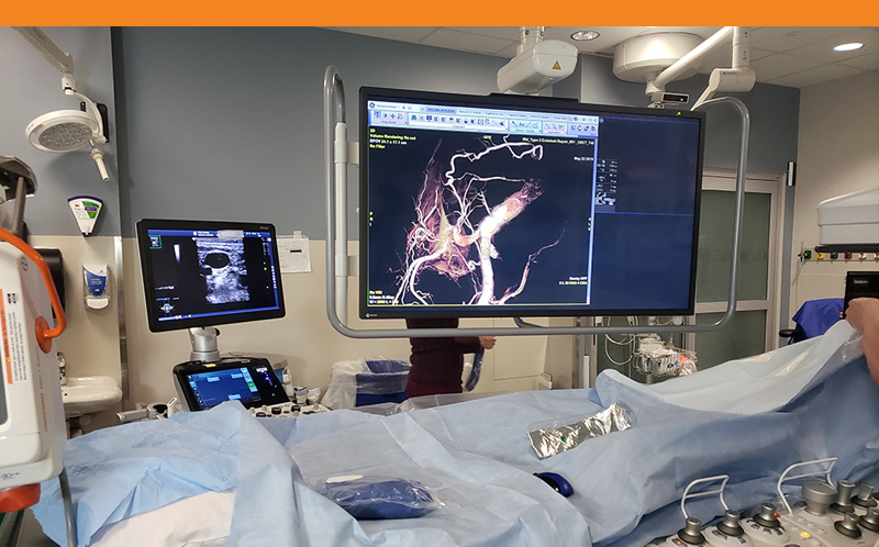 Photo of Operating Room with imaging scans on monitor