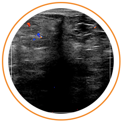 Photo of Duke breast biopsy imaging results