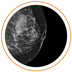 Photo of breast imaging results