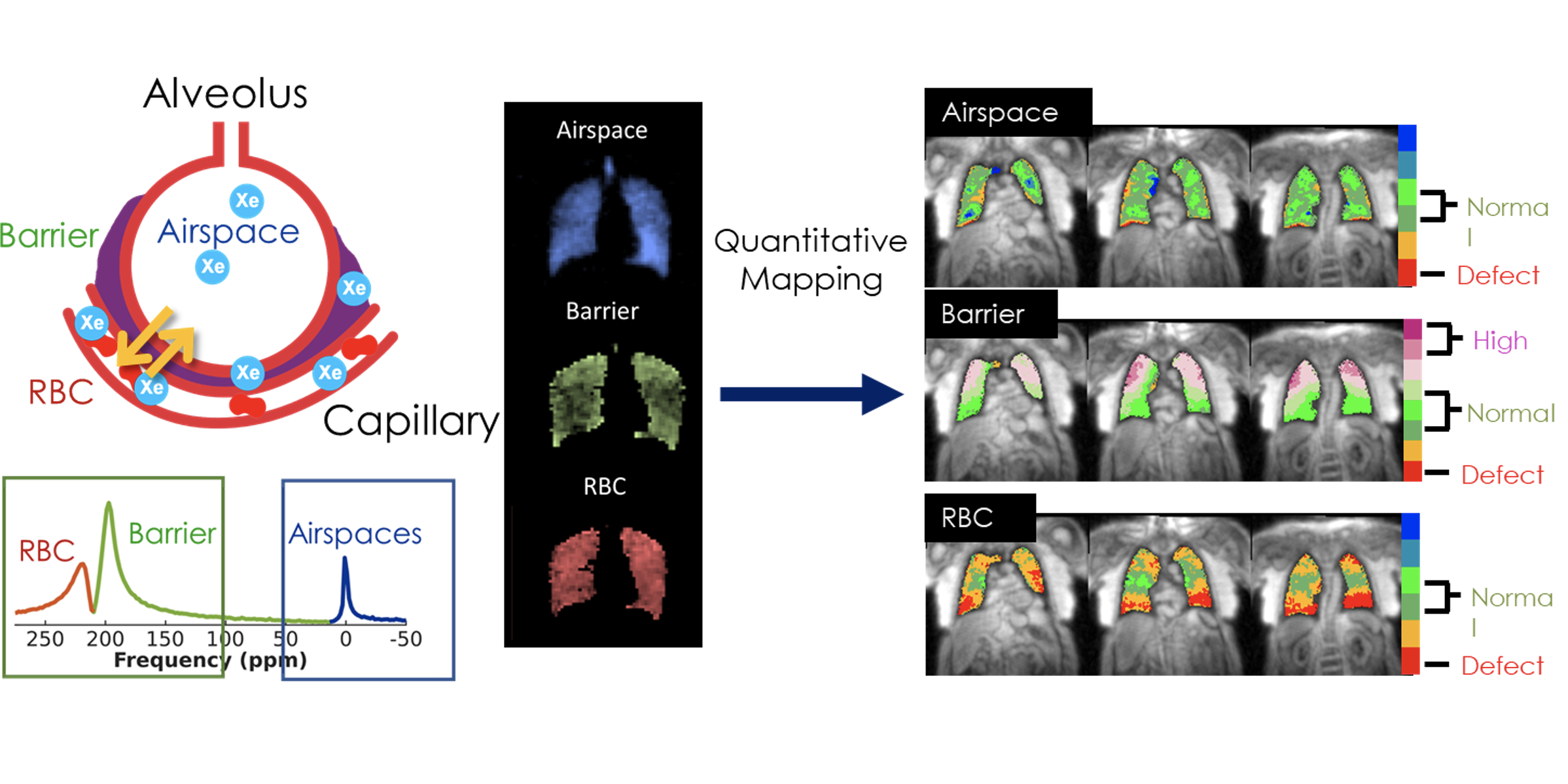 Hyperpolarized xenon gas (Xe) is inhaled into the lung airspaces and diffuses into the soft tissues (barrier) and blood stream (RBC). 