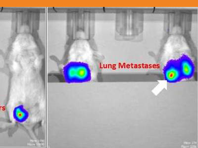 Lung scan