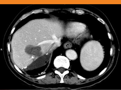 Radiology image