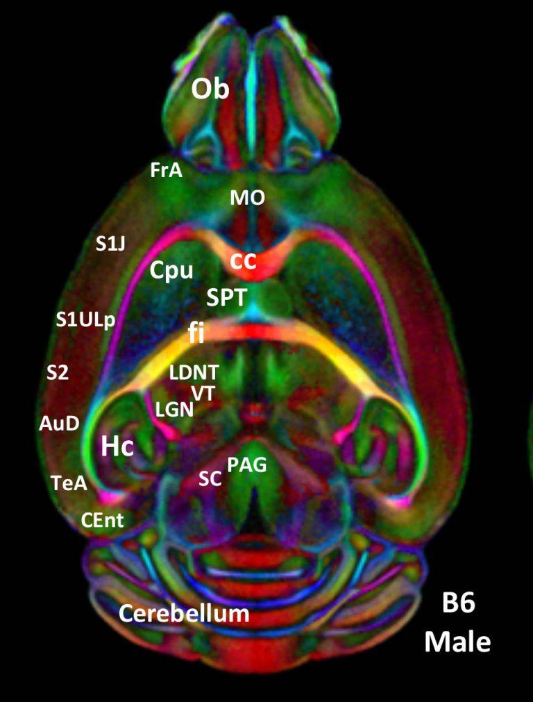 Scan of mouse brain