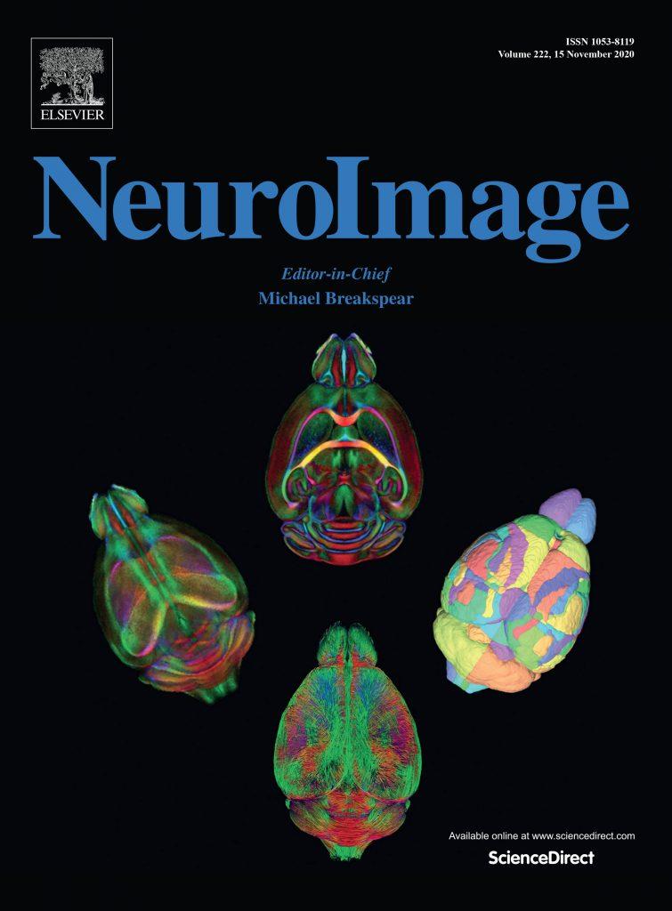 NeuroImage journal cover