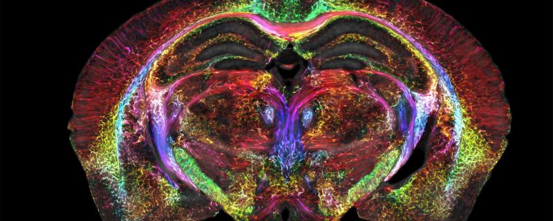 Mouse brain image