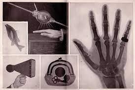 Roentgen x-ray discovery images