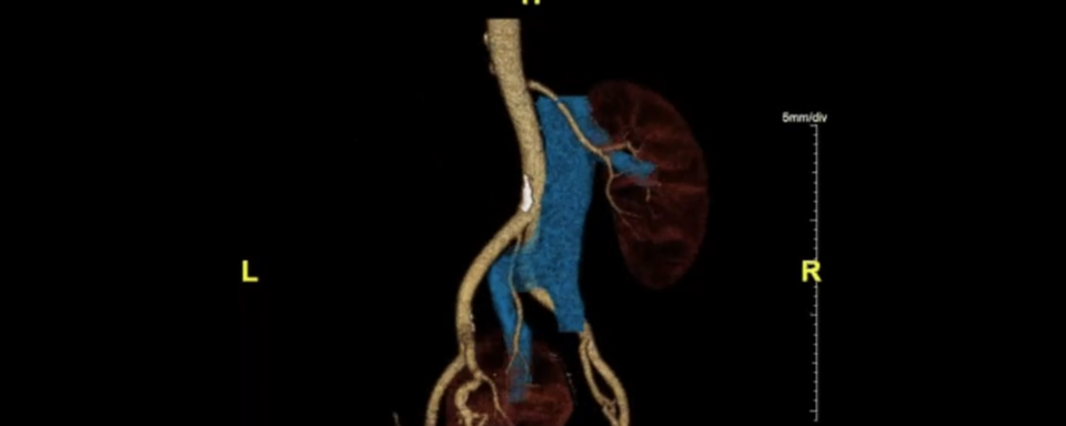 Abdominal imaging example