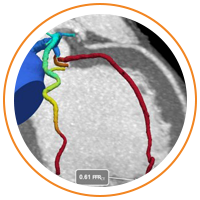 Image of a tomographic scan
