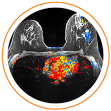 Photo of MRI scan imaging