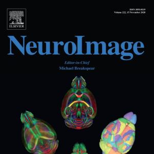 NeuroImage journal cover