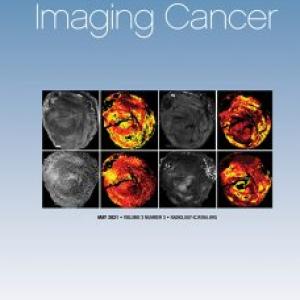 Radiology: Imaging Cancer cover