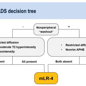 MLI-RADS decision tree
