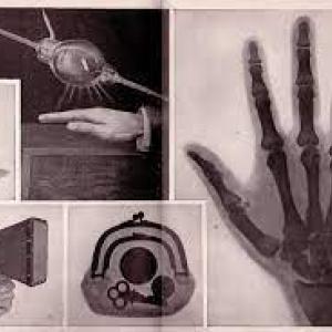 Roentgen x-ray discovery images